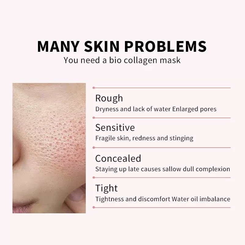 You need a bio collagen ask